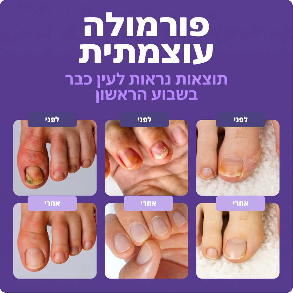 עט  לטיפוח הציפורניים