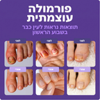 עט  לטיפוח הציפורניים
