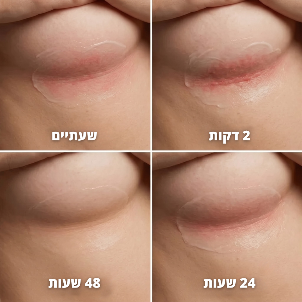 סטיק נגד שפשפות - ™clinelle