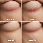סטיק נגד שפשפות - ™clinelle