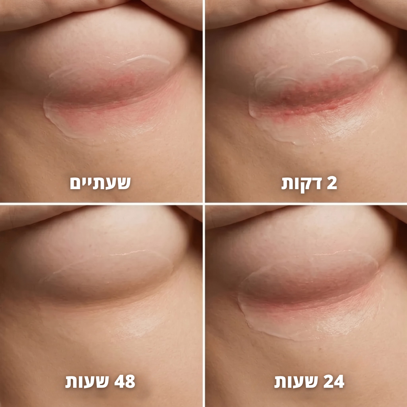 סטיק נגד שפשפות - ™clinelle