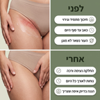 סטיק נגד שפשפות - ™clinelle