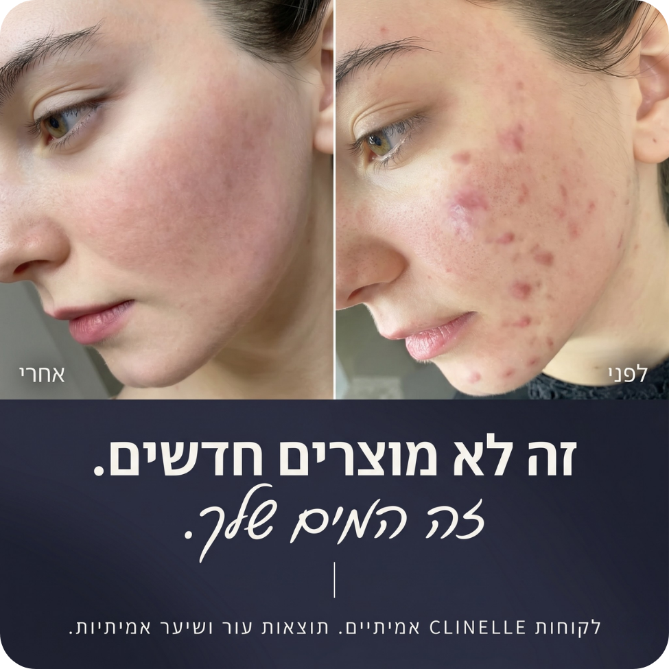 ראש המקלחת המסנן - clinelle