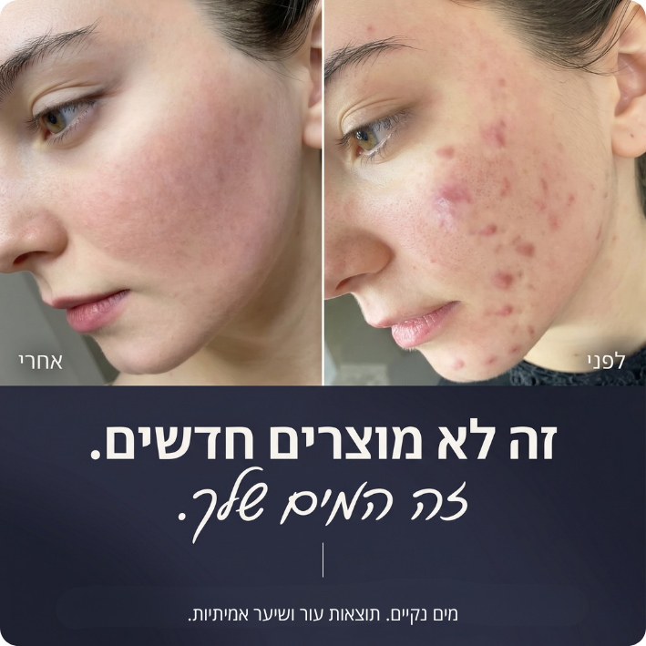 ראש המקלחת המסנן - clinelle